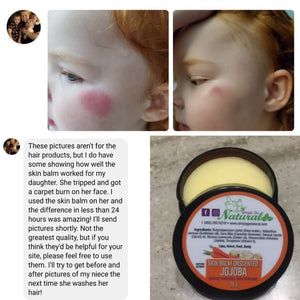 Sensitive Skin, Dry Skin Problems, Dry Skin Care Needs ?