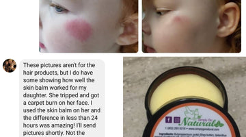 Sensitive Skin, Dry Skin Problems, Dry Skin Care Needs ?