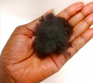 Are you shedding or Alopecia ?